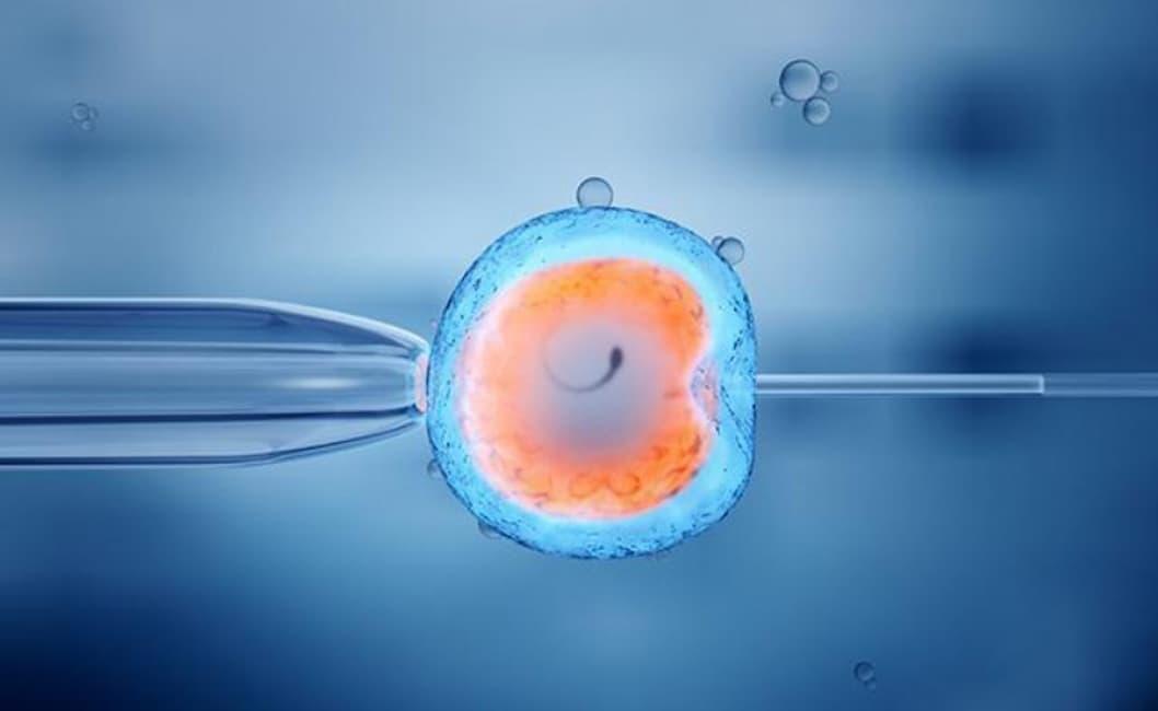 IVF/ ICSI