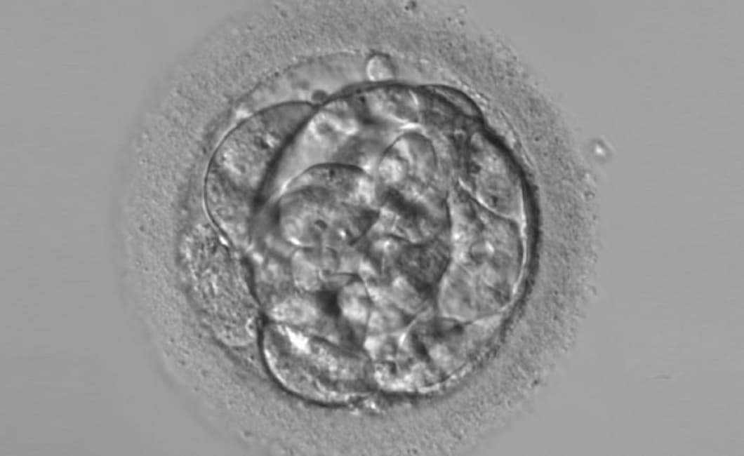 Blastocyst / Freezing /FETs